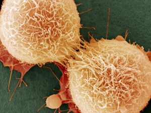 Photo credit: Nearly two-thirds of cell mutations that cause cancer are caused by random error, a study found. (Steve Gschmeissner/Science Source)