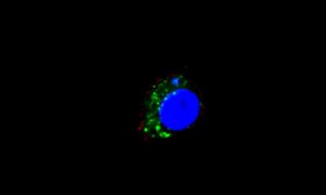 Mouse macrophages (blue) take up tumor cell-derived exosomes (green), triggering an inflammatory cascade that prolongs cancerous growth. Credit: Franziska Haderk, German Cancer Research Center (DKFZ), Heidelberg