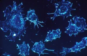 Photo: An engineer-led study that shows how cancer spreads throughout the body may give hope for treatments that could one day stop the deadly cells in their tracks.