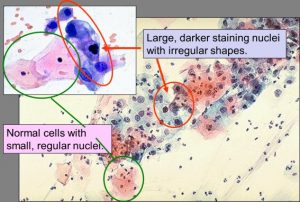 nuclei