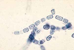 Anthroconidia of Coccidioides immitis.