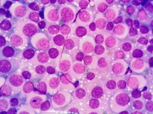 CTVT Cells