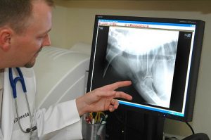 bone cancer xray 1