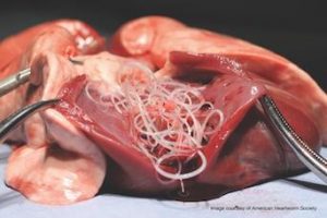 Heartworm-AHS_Feature