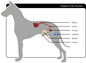 benign prostatic hyperplasia complications