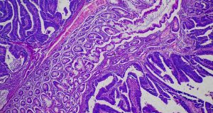 Most cancer drugs fail in testing. This might be a big reason why.