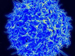 Scanning electron micrograph of a human T lymphocyte (also called a T cell) from the immune system of a healthy donor. Credit: NIAID