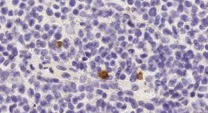 A New Pathway To “Reprogram” Killer Cells