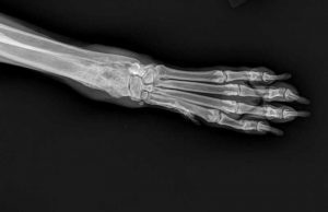 Osteosarcoma of the radius in an eight-year-old Labrador