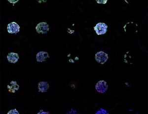 Chemical array draws out malignant cells to guide individualized cancer treatment