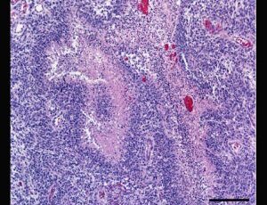 Hope for glioblastoma victims seen in dog experiments underway at Virginia Tech